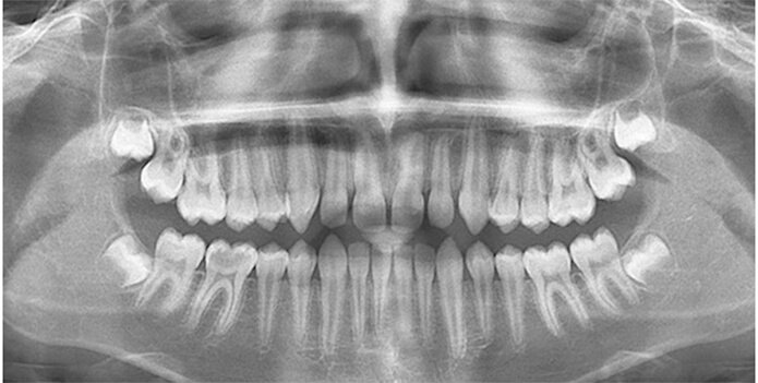 3д снимок зубов и челюсти