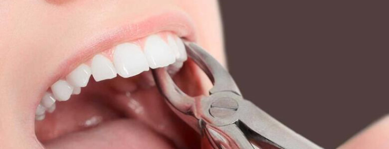 На изображении челюсть девушки, у которой хотят удалить зуб, Евродент фото