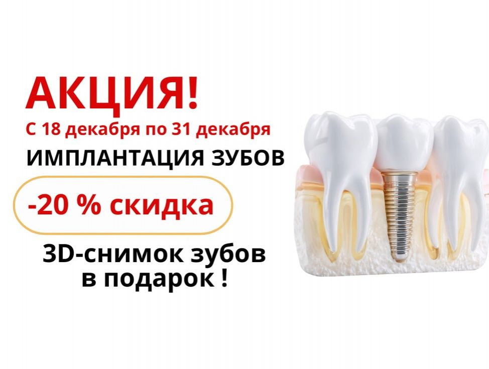 Новогодняя акция –20% на имплантацию зубов