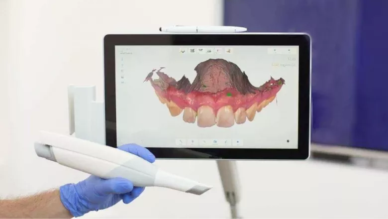 Цифровая ортодонтия