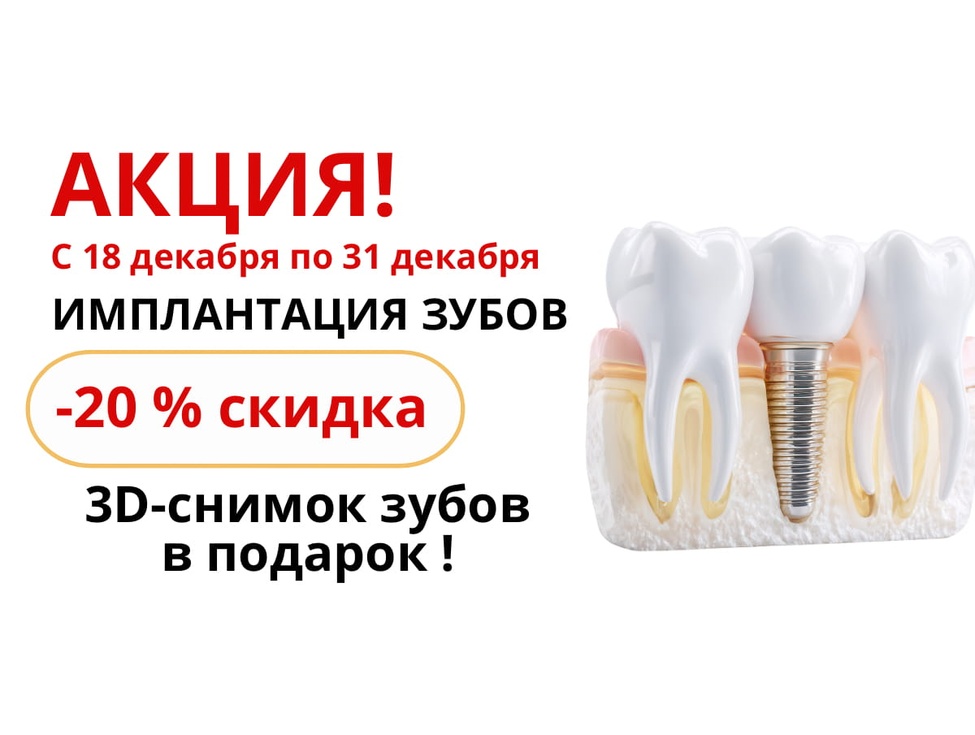 Новогодняя акция –20% на имплантацию зубов