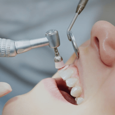 На изображении стоматолог выполняет процедуру подпиливания зубов, Евродент фото