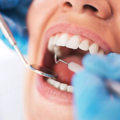 На изображении, стоматолог делает осмотр зубов у пациента