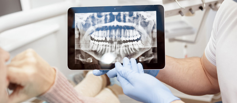 На изображении, врач-стоматолог показывает пациенту его снимок зубов