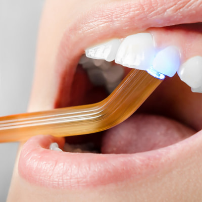 На изображении, стоматолог проводит процедуру пломбирования зуба у пациента