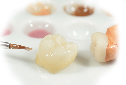 Микропротезирование зубов керамическими вкладками
