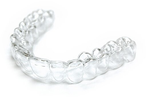 Элайнеры StarSmile - красивые зубы без боли и дискомфорта, верхнее фото