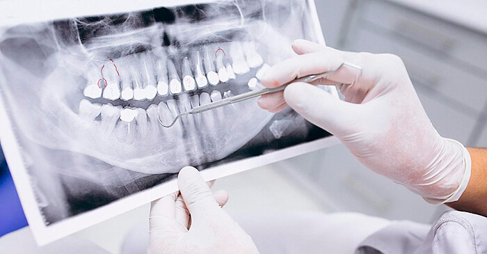 ошибки в ортопедической стоматологии, фото Eurodent