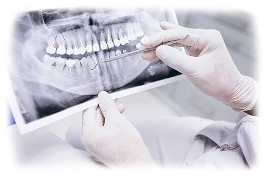 Ошибки в стоматологии: что нужно знать пациенту, верхнее фото
