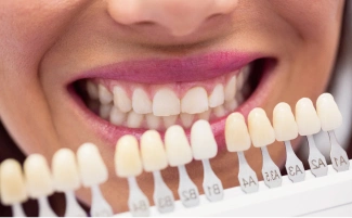 Определение цвета зубов по шкале Вита, фото Евродент