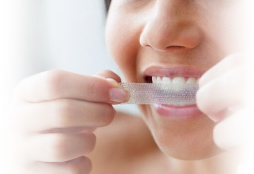 Почему отбеливание зубов в домашних условиях может быть опасным для здоровья, верхнее фото