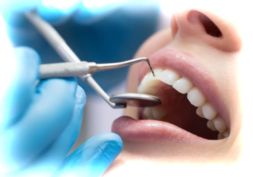 Профилактика кариеса: как сохранить зубы здоровыми, верхнее фото