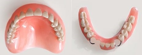 Фото сьемных зубных протезов