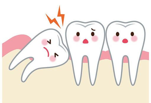 Ретинированный зуб - что делать, если зуб не прорезался?, верхнее фото
