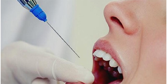 как делают анестезию в стоматологии