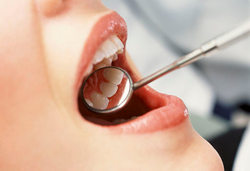 Удаление зубов: показания к удалению и способы, верхнее фото