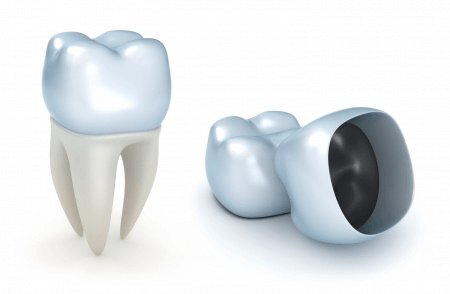 Коронка на зуб – эстетично, надежно, доступно, верхнее фото