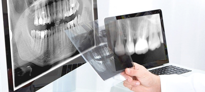 Диагностика зубов, фото Евродент
