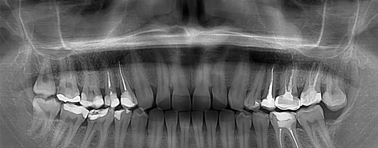 Что показывает рентген зуба, фото Eurodent