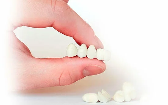 Протезирование <br>зубов - в клинике Евродент фото