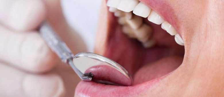 На изображении улыбка девушки, у которой стоматолог осматривает зубы, Евродент фото 2