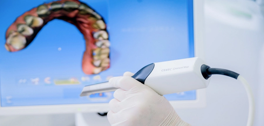 Cканирование зубов интраоральным 3d сканером, фото Евродент