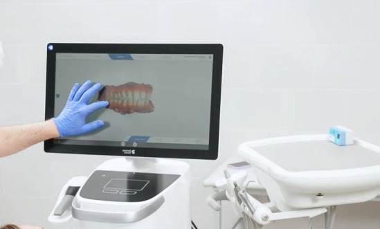 Процесс сканирования ротовой полости с помощью 3d сканера, фото Евродент